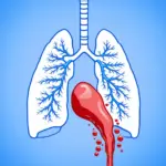 Pulmonary Embolism Illustration