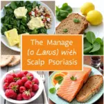 Healthy foods for scalp psoriasis