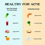 Acne and Diet