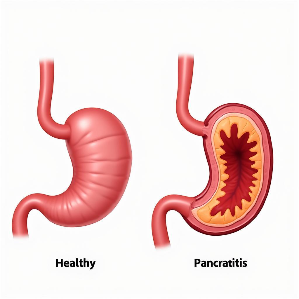 Inflammation of the pancreas