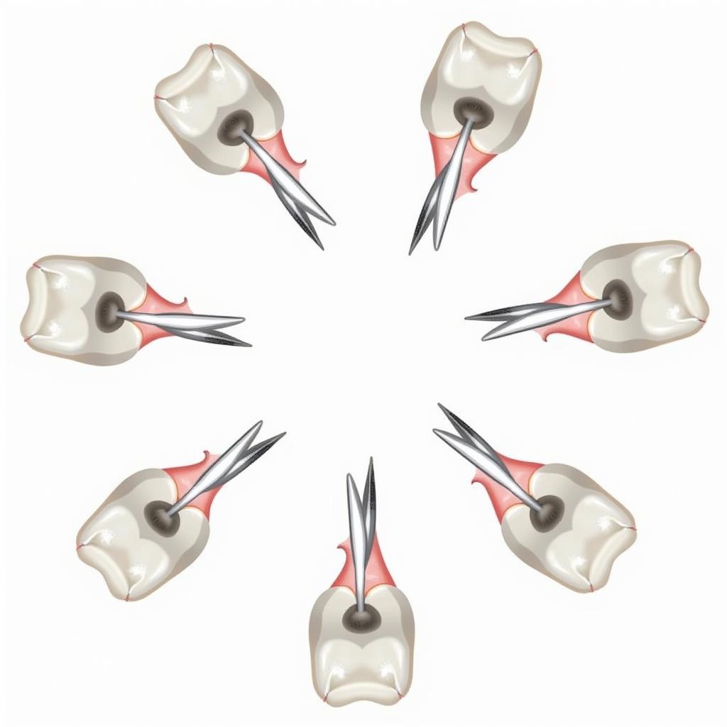 Wisdom Tooth Extraction Procedure Steps